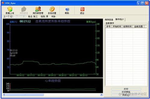 多功能电子听诊器 cms vesd 产品使用说明